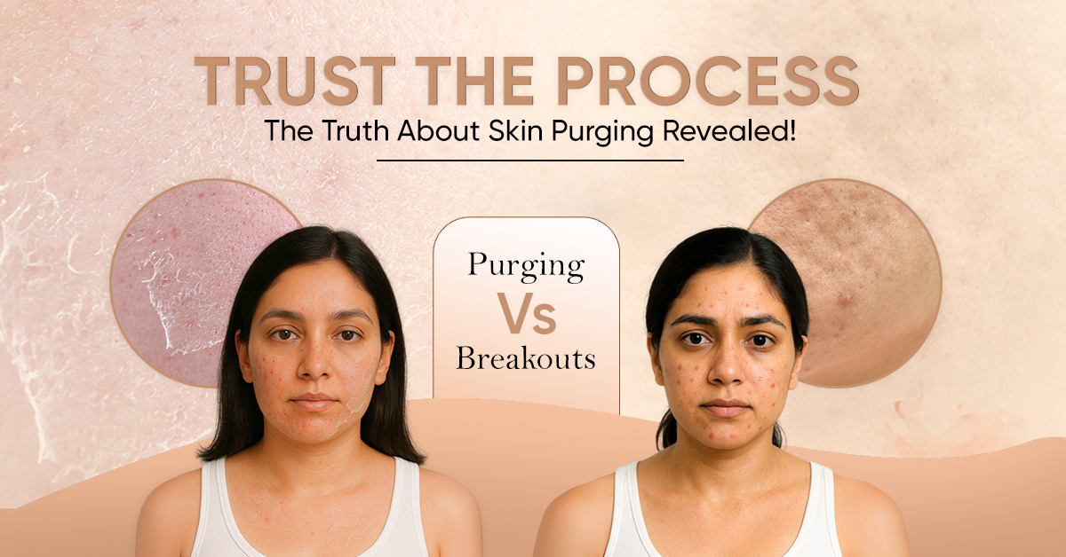 The Truth About Skin Purging When Using Active Serums