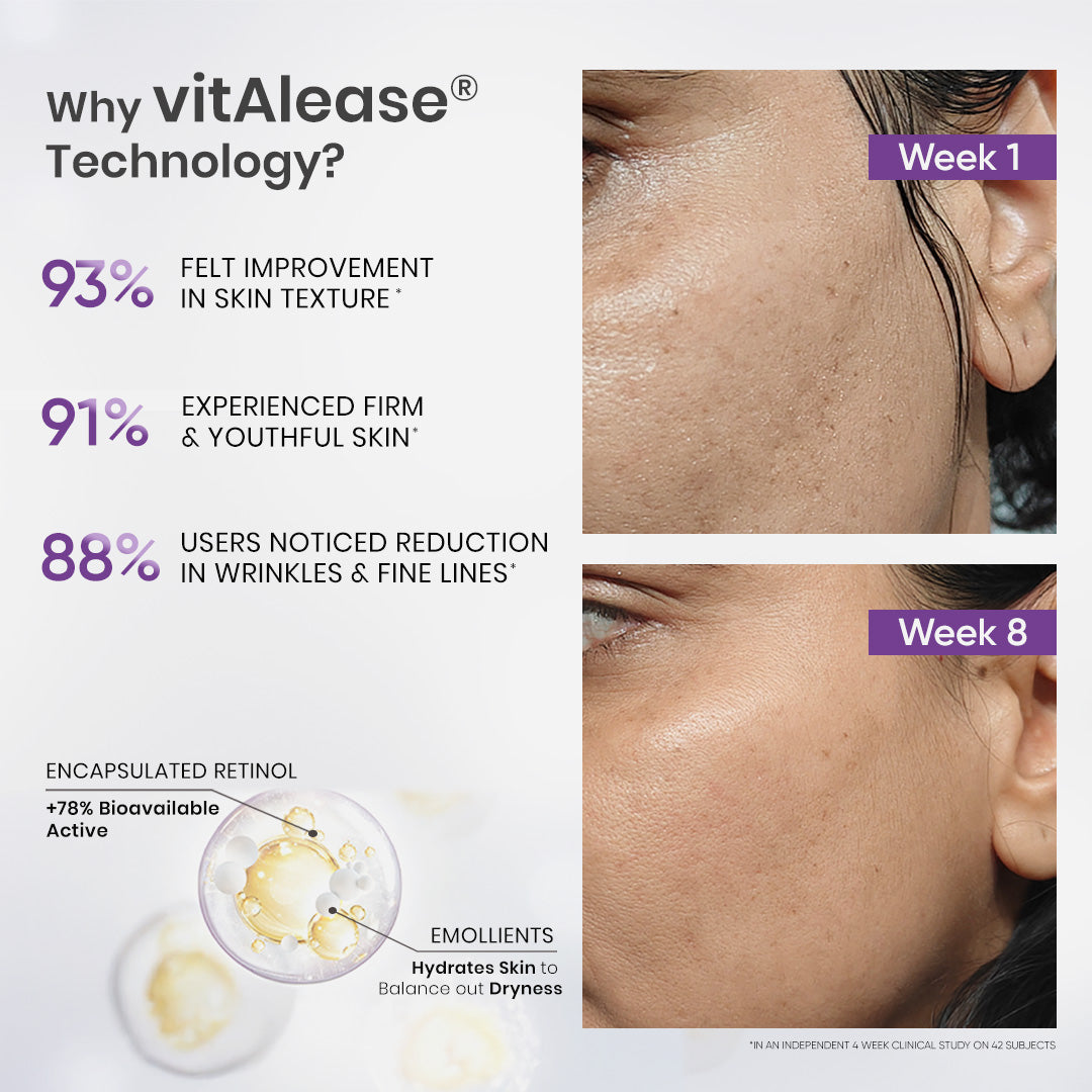 Retinol Night Cream (50g) | For Anti-Aging & Wrinkle Protection