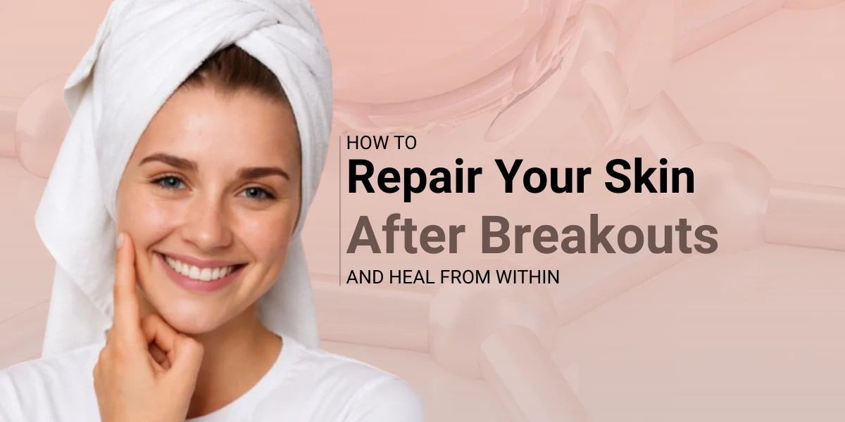 How to repair your skin after breakouts and heal acne marks with the right skincare routine