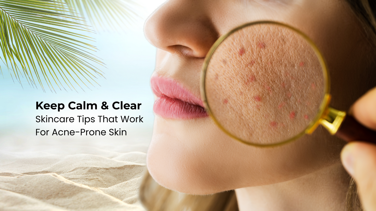 Summer pimples on face getting worse in India's heat? Dermatologist-approved skincare tips to prevent breakouts and keep acne-prone skin clear all season.