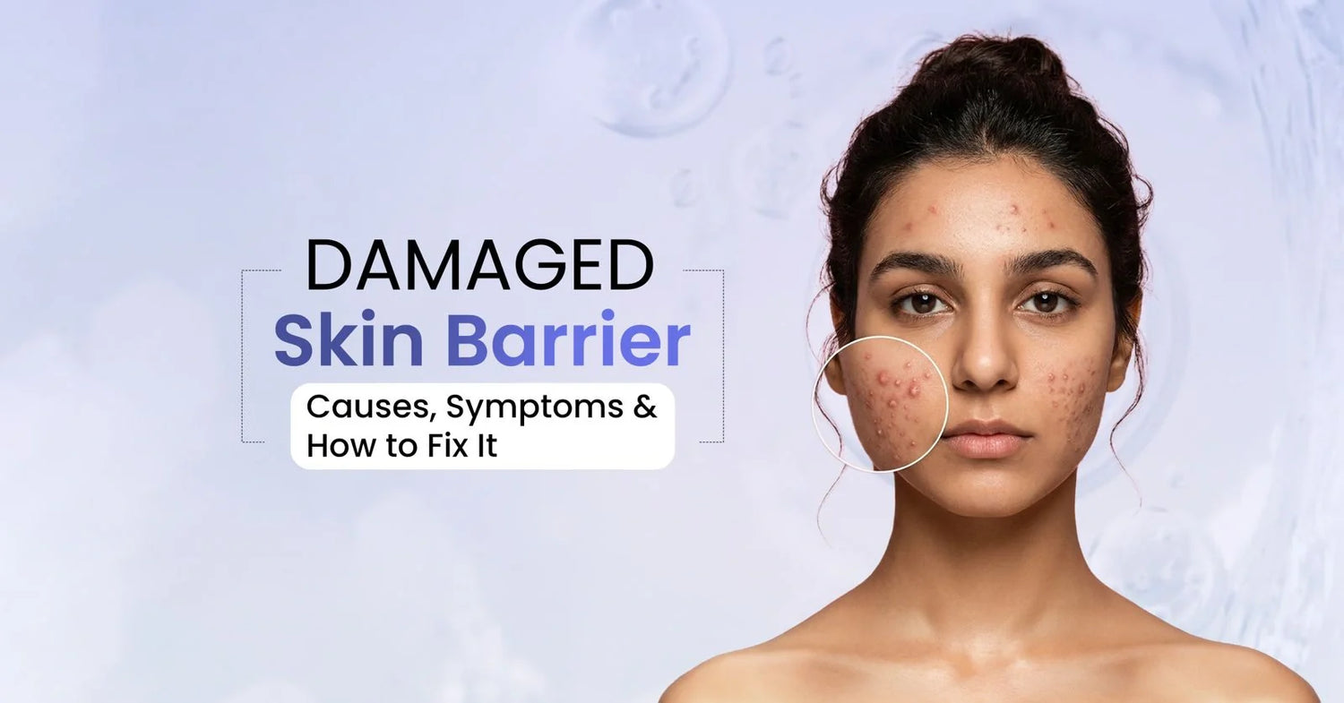 How to identify and repair a damaged skin barrier with expert-backed tips on symptoms, causes, barrier-strengthening ingredients, and skincare routines.