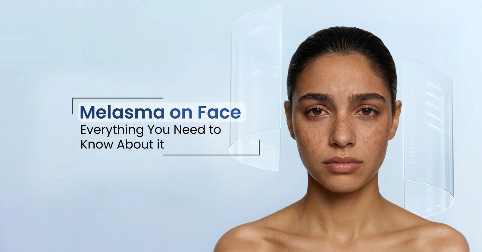 Melasma on the face explained, including its causes, symptoms, triggers, and effective treatments for reducing facial pigmentation and dark patches.