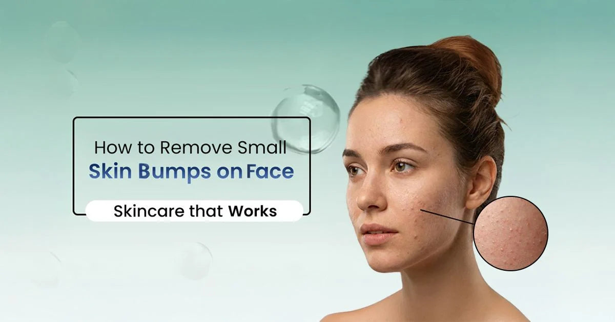 How to Get Rid of Small Skin Bumps on the Face and Forehead and Understand the causes of little bumps on face & explore effective treatment to reduce.