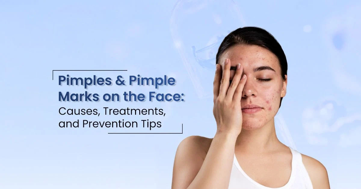 Pimple marks on face and acne dark spots explained with safe treatments to remove dark pimple marks.