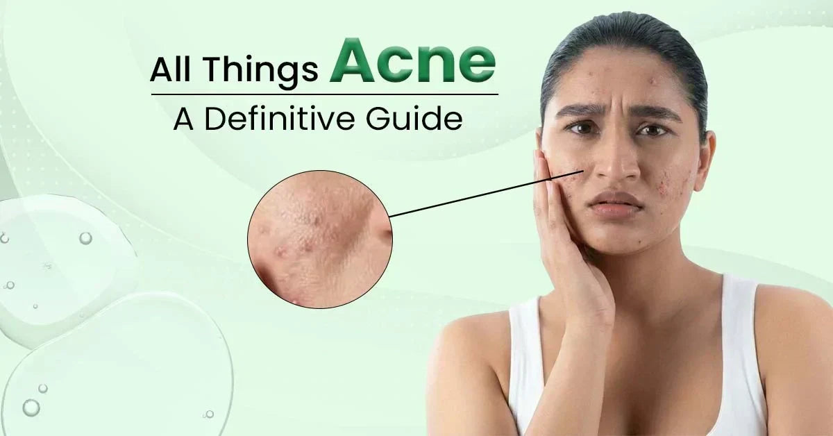 Definitive guide to acne covering causes, types of acne, treatments, and prevention tips
