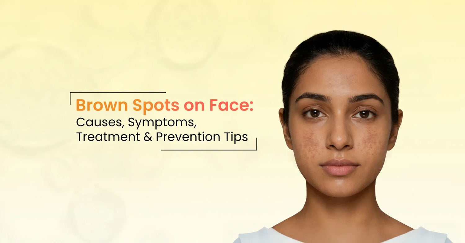 Brown spots on face causes, treatment options, and prevention tips for hyperpigmentation and dark spots