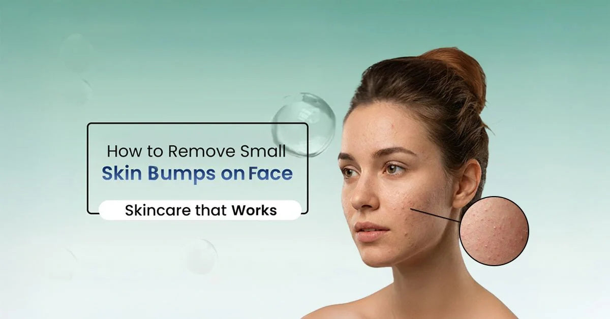 How to Get Rid of Small Skin Bumps on the Face and Forehead and Understand the causes of little bumps on face & explore effective treatment to reduce.