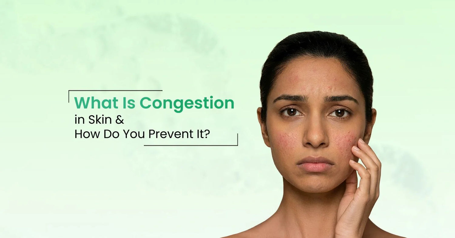 Discover what congestion in skin is, its causes, and effective prevention tips to maintain a clear, healthy complexion.