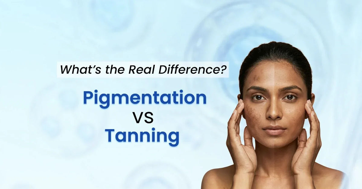 Pigmentation vs tanning difference on face – skincare guide for dark spots, sun tan and uneven skin tone with SkinInspired sunscreen awareness.