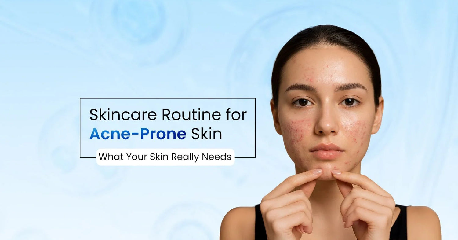 Acne-prone skincare routine guide featuring a woman with active acne and blemishes, highlighting the best skincare routine for acne-prone skin and clearer-looking skin