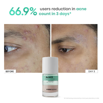 AcNil3 Acne Spot Corrector (12ml)