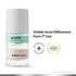 Buy SkinInspired Acne Spot Corrector with Salicylic Acid and Colloidal Sulfur