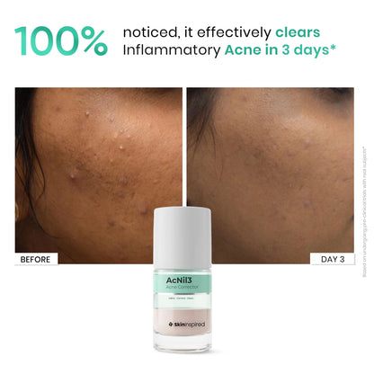 Acnil Acne Spot Corrector with Salicylic Acid Result