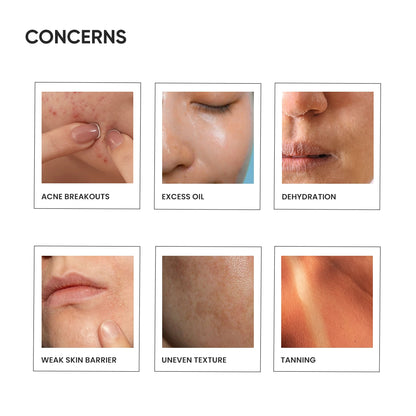 Skin Renewal Combo Pack Concern Image 