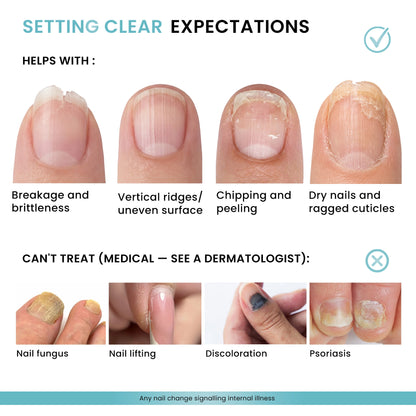 Skininspired | Nail growth serum benefits include stronger nails, healthier cuticles and reduced nail breakage
