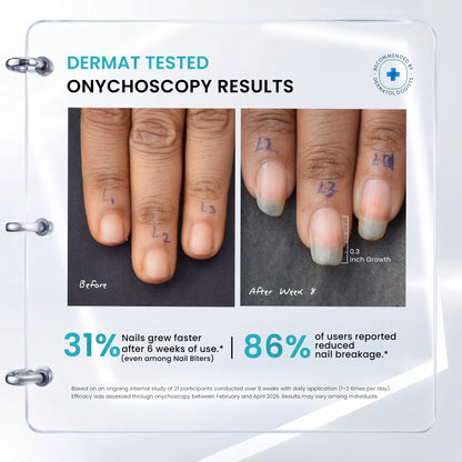 Dermat Tested Onychoscopy Before and After Result 