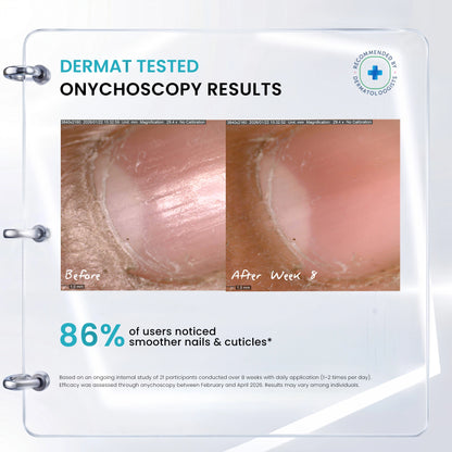 Before and after results of nail repair serum showing stronger, smoother and healthier nails