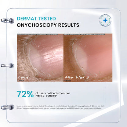 Before and after results of nail repair serum showing stronger, smoother and healthier nails