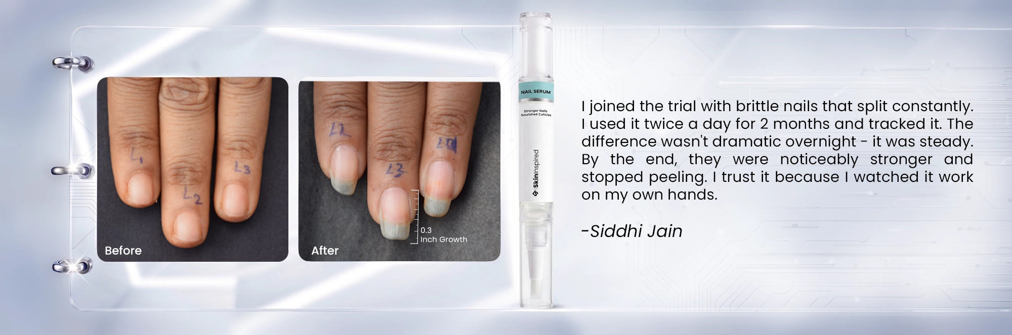 Customer Review and Real Result Images of Skininspired Nail serum 