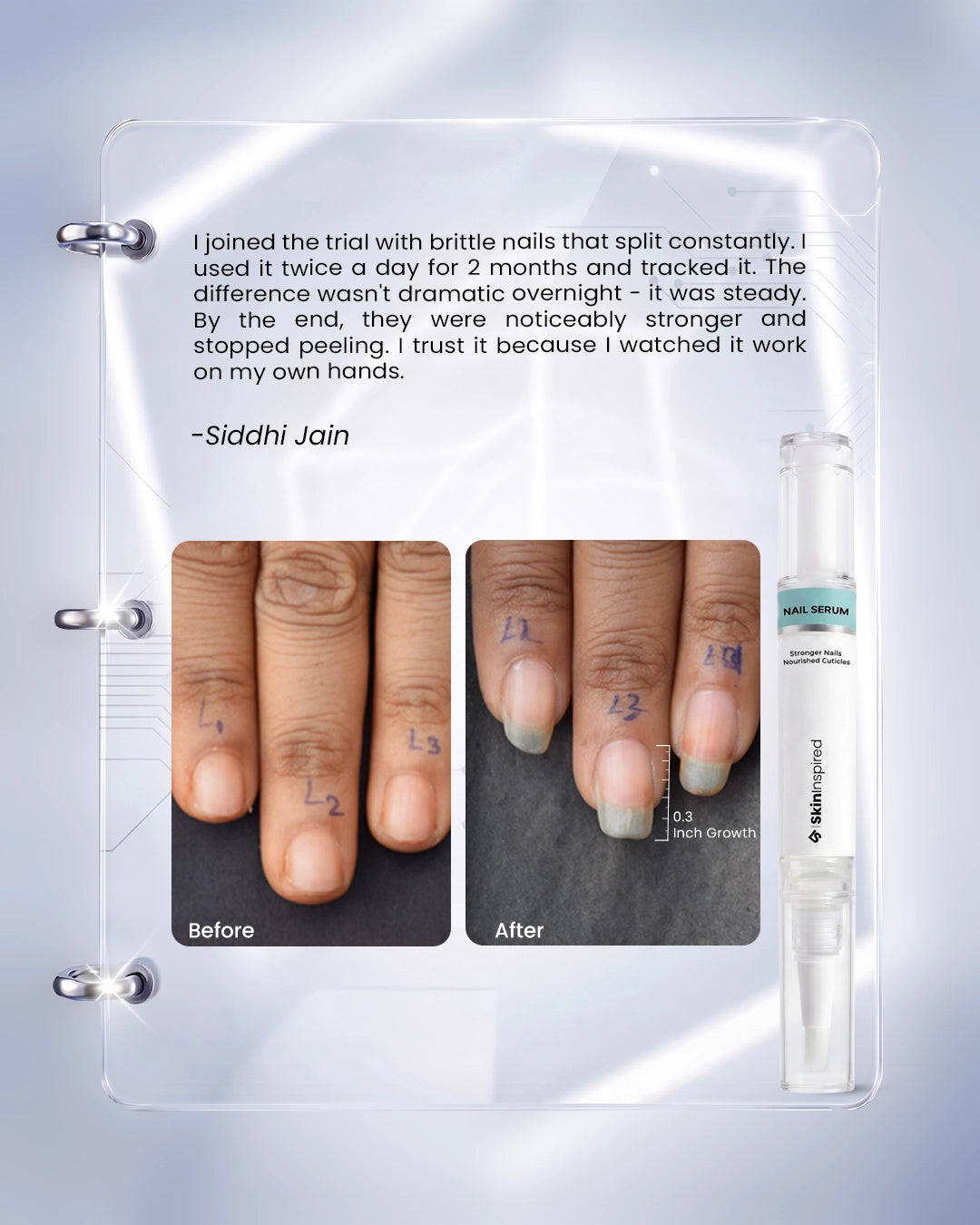 Customer Review and Real Result Images of Skininspired Nail serum for Growth and Strong Nails