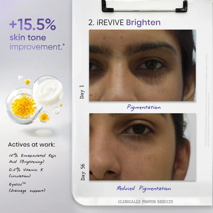 Best under eye serum for reducing pigmentation