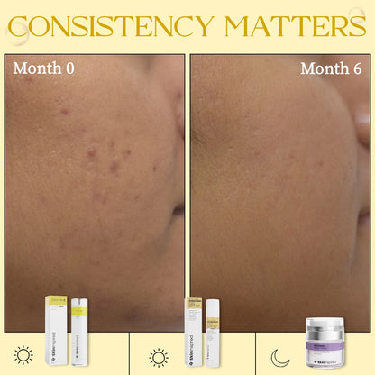 Consistency matters results of SkinInspired Vitamin C serum showing visible improvement in skin tone and clarity
